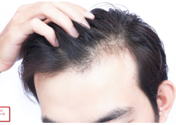stop hair loss